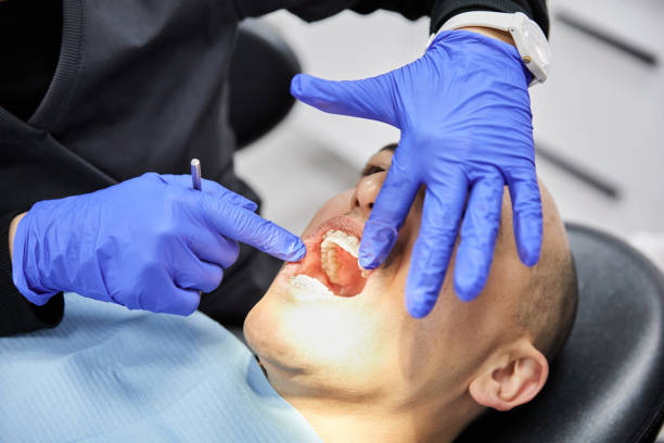 Best Dentist for Tooth Abscess  in Fort Belvoir, VA